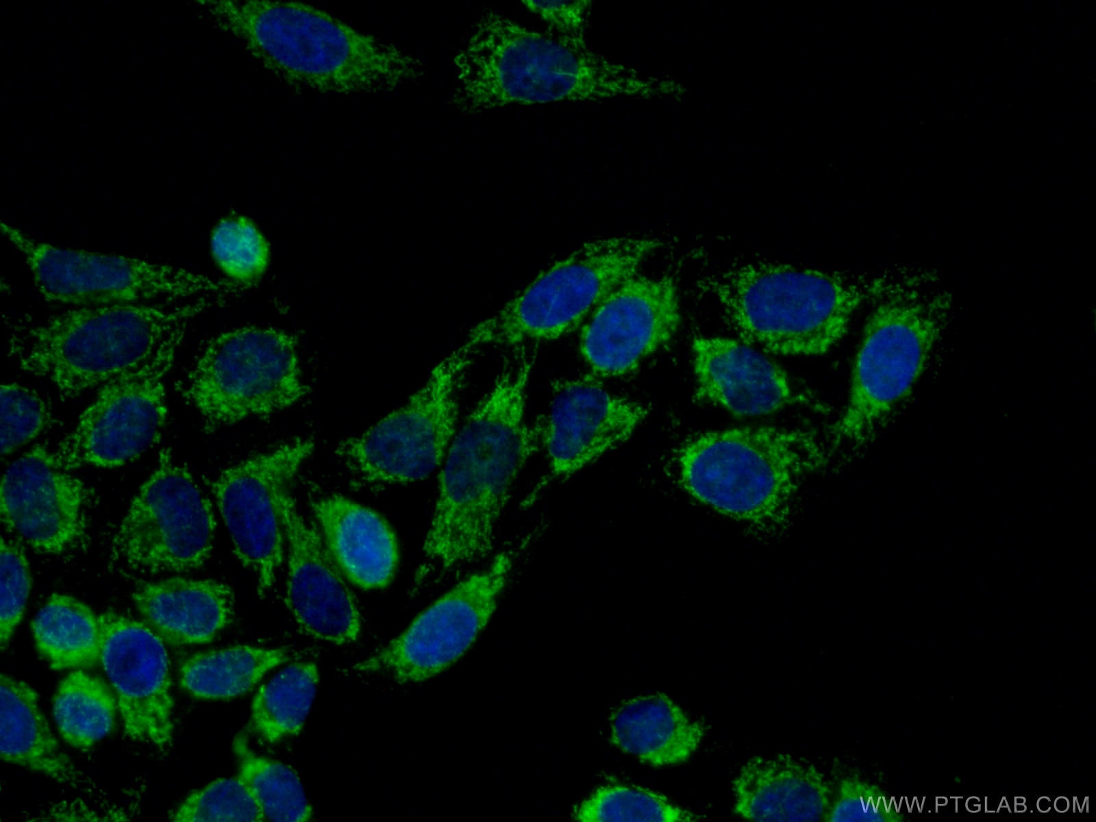 Immunofluorescence (IF) / fluorescent staining of HepG2 cells using LONP1 Polyclonal antibody (15440-1-AP)