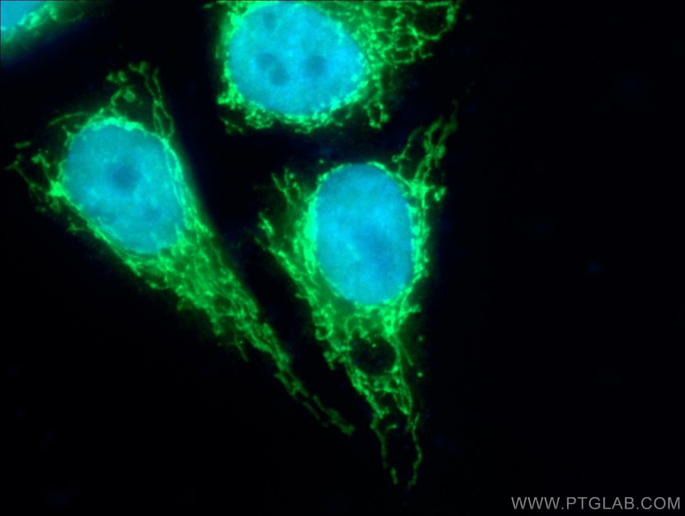 IF Staining of HepG2 using 15440-1-AP