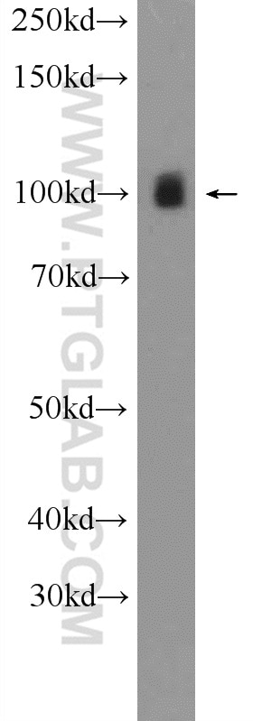 Western Blot (WB) analysis of mouse heart tissue using LONP1 Polyclonal antibody (15440-1-AP)