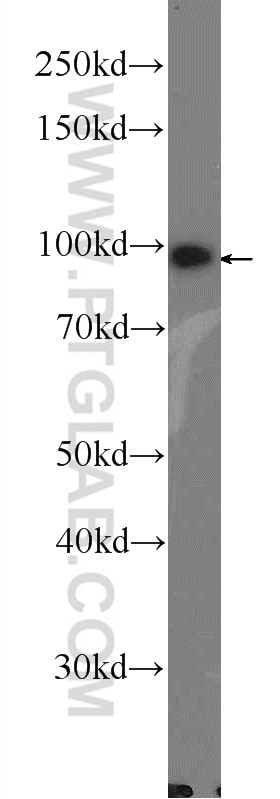 Western Blot (WB) analysis of rat heart tissue using LONP1 Polyclonal antibody (15440-1-AP)