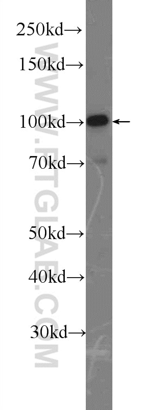 Western Blot (WB) analysis of rat lung tissue using LONP1 Polyclonal antibody (15440-1-AP)