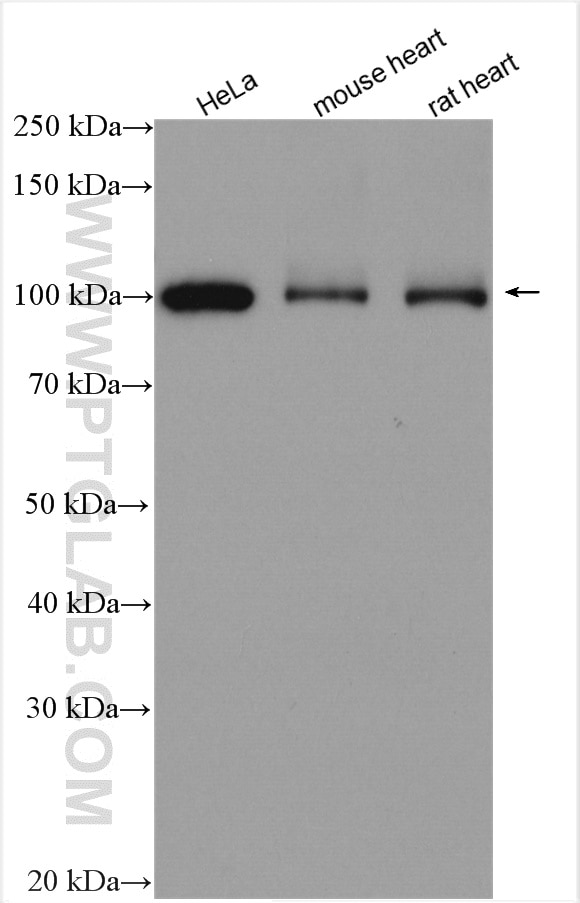 Western Blot (WB) analysis of various lysates using LONP1 Polyclonal antibody (15440-1-AP)