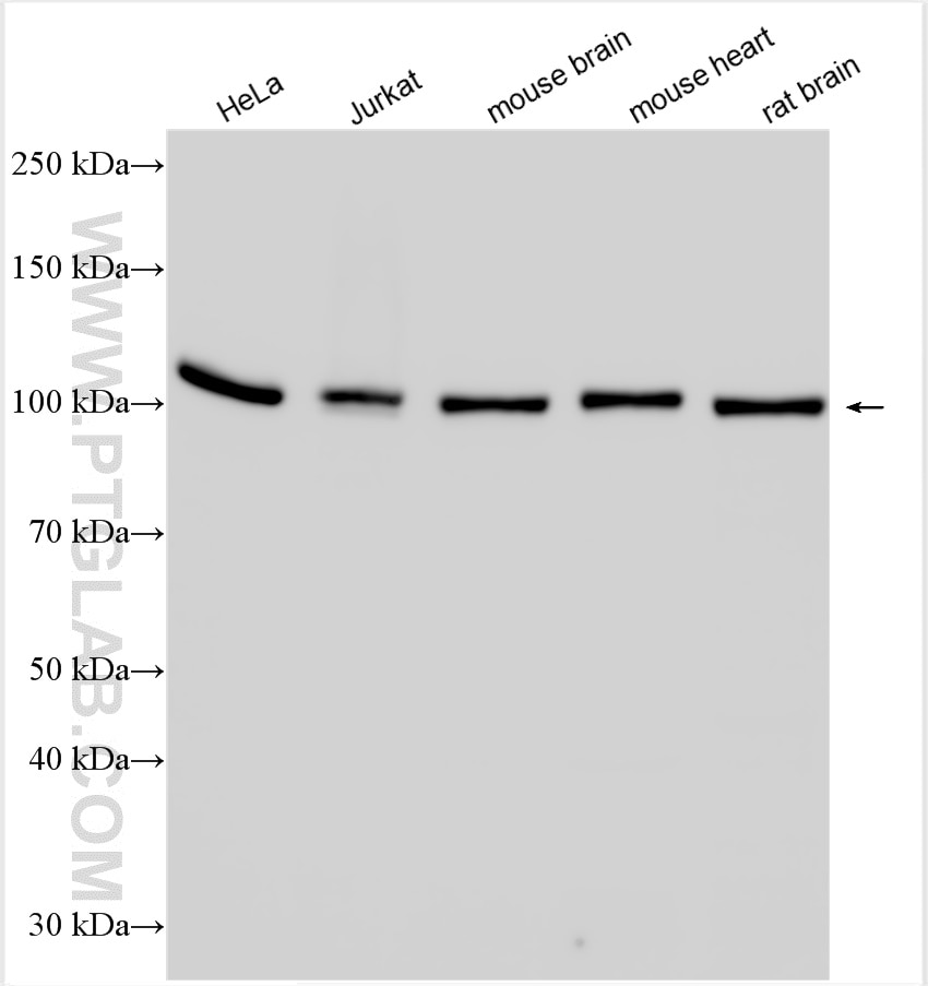 Western Blot (WB) analysis of various lysates using LONP1 Polyclonal antibody (15440-1-AP)