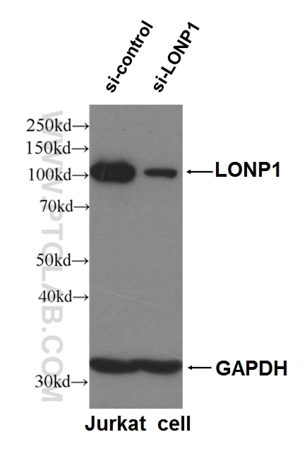 Western Blot (WB) analysis of Jurkat cells using LONP1 Polyclonal antibody (15440-1-AP)