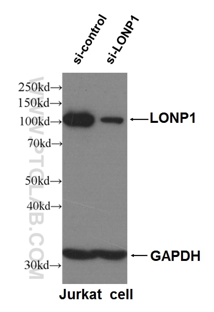 WB analysis of Jurkat cells using 15440-1-AP