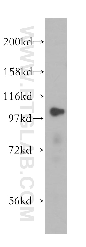 Western Blot (WB) analysis of HeLa cells using LONP1 Polyclonal antibody (15440-1-AP)