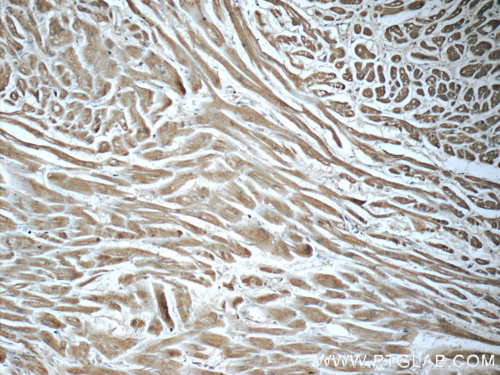 IHC staining of human heart using 66043-1-Ig