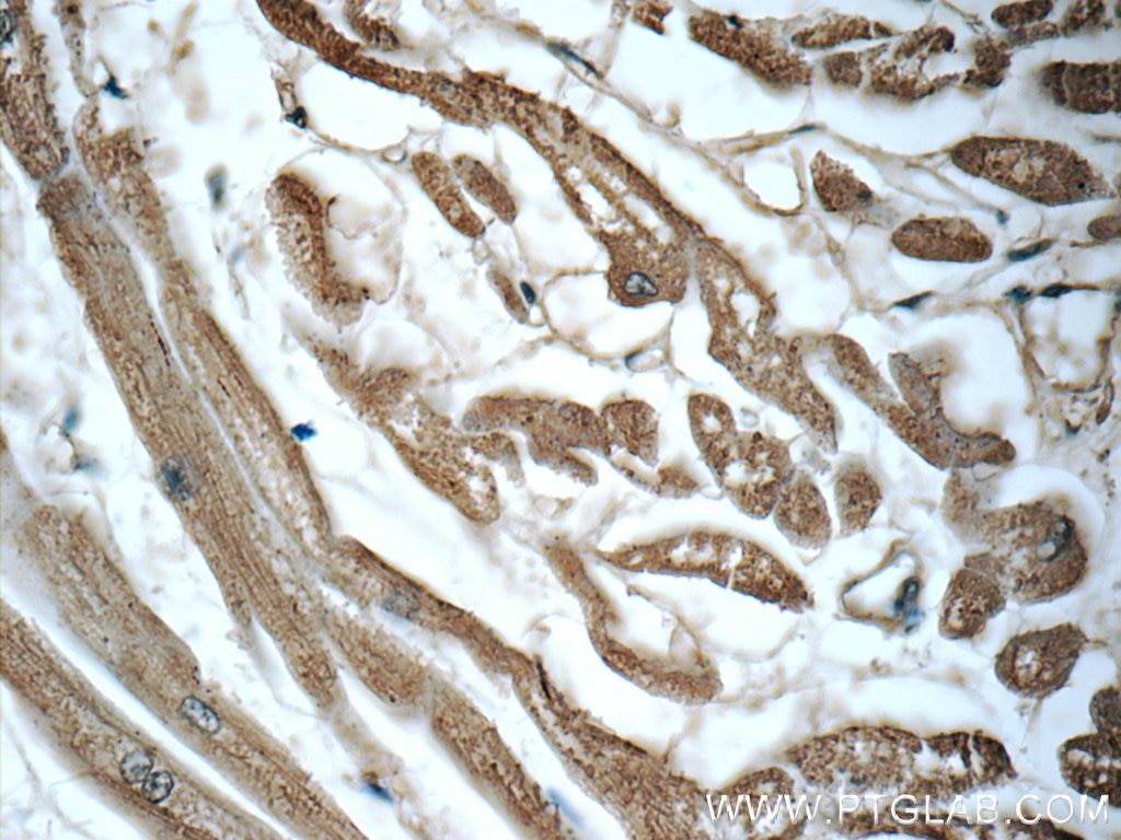 Immunohistochemistry (IHC) staining of human heart tissue using LONP1 Monoclonal antibody (66043-1-Ig)