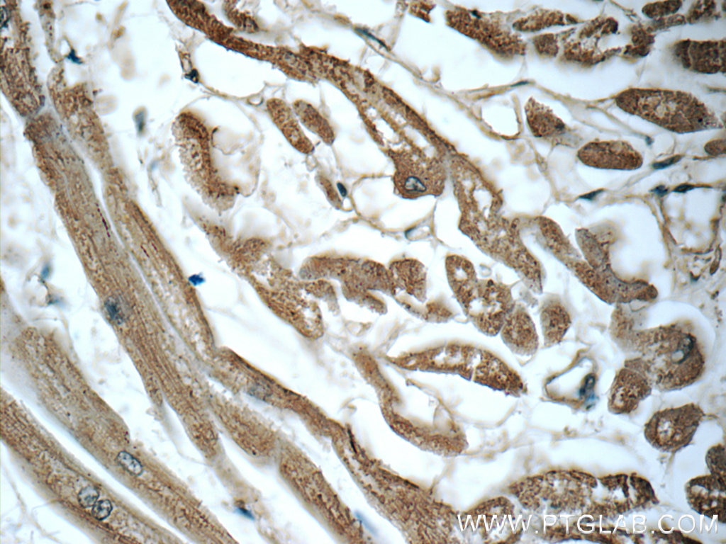 IHC staining of human heart using 66043-1-Ig