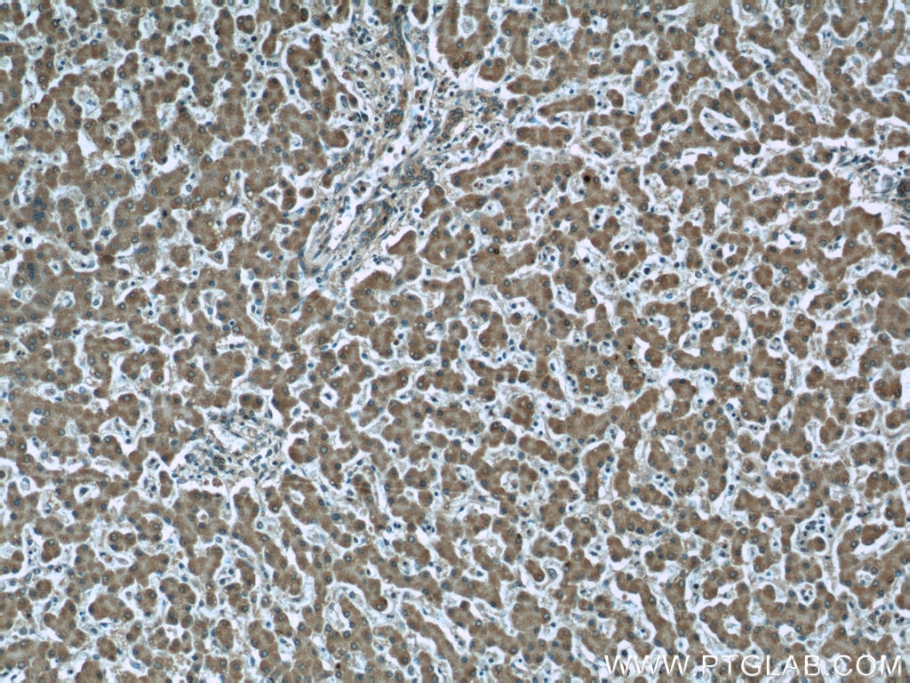 Immunohistochemistry (IHC) staining of human liver tissue using LONP1 Monoclonal antibody (66043-1-Ig)