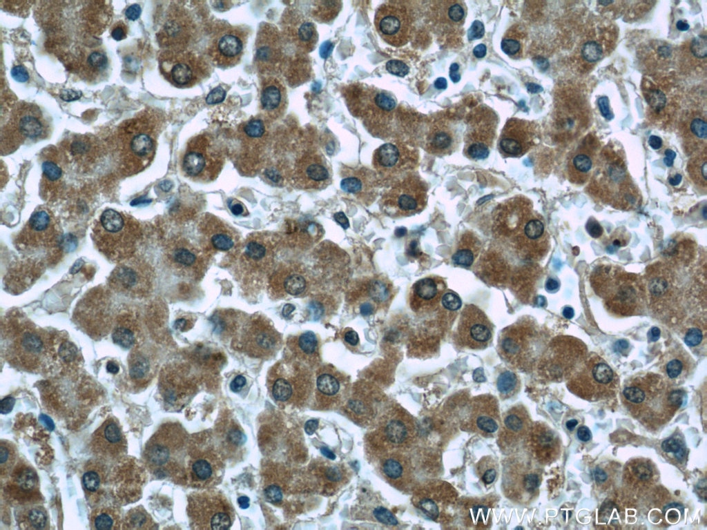 Immunohistochemistry (IHC) staining of human liver tissue using LONP1 Monoclonal antibody (66043-1-Ig)