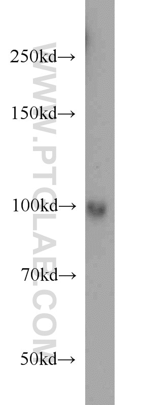 Western Blot (WB) analysis of human liver tissue using LONP1 Monoclonal antibody (66043-1-Ig)