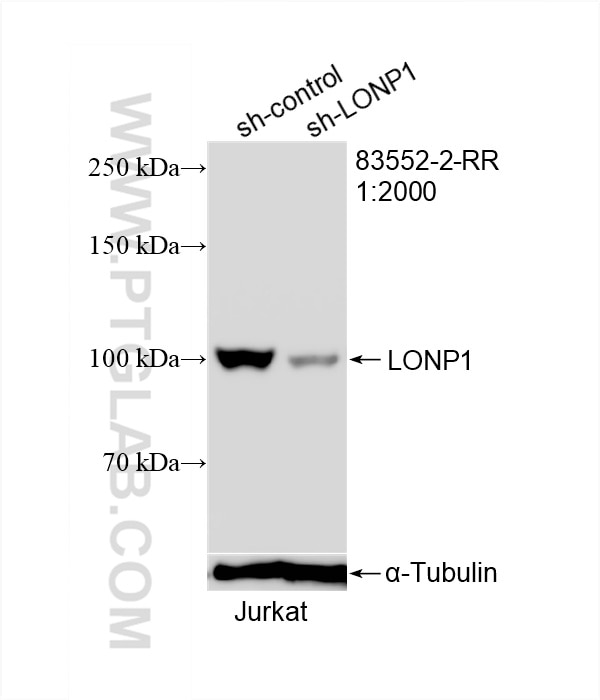 Western Blot (WB) analysis of Jurkat cells using LONP1 Recombinant antibody (83552-2-RR)