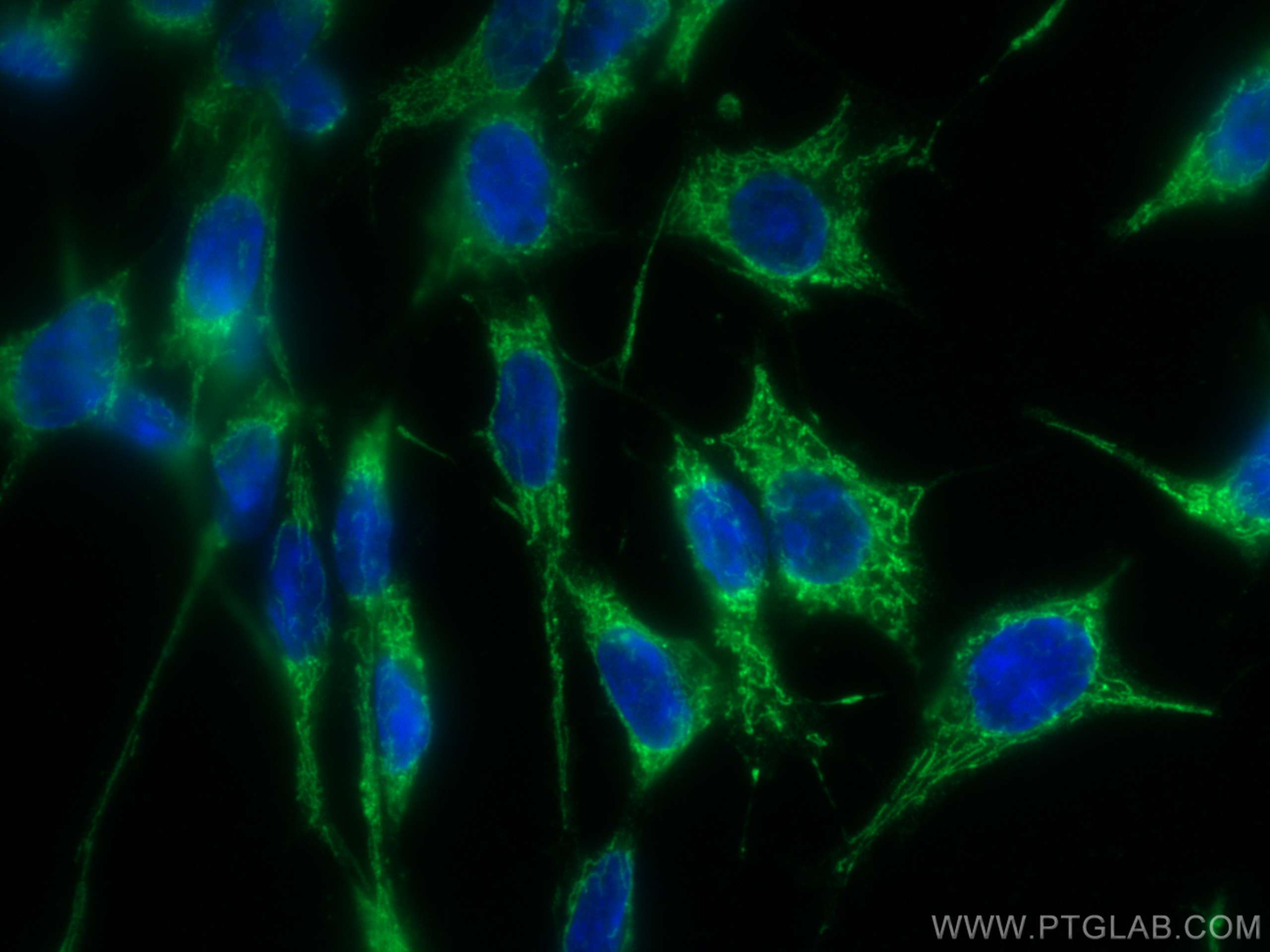 Immunofluorescence (IF) / fluorescent staining of C6 cells using CoraLite® Plus 488-conjugated LONP1 Monoclonal ant (CL488-66043)