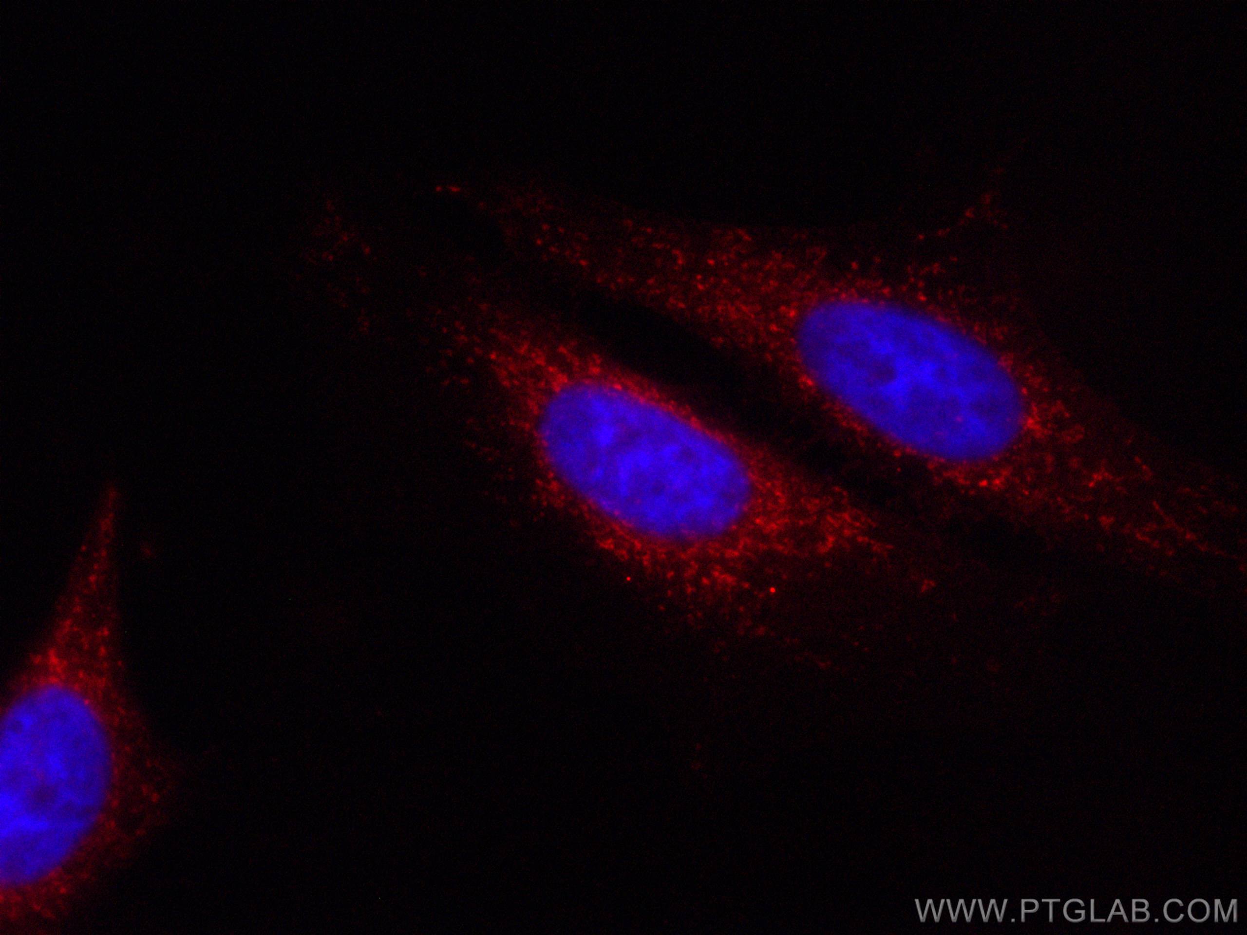 Immunofluorescence (IF) / fluorescent staining of HepG2 cells using CoraLite®594-conjugated LONP1 Polyclonal antibody (CL594-15440)