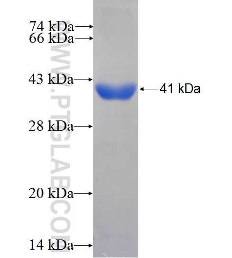 LONP1 fusion protein Ag7306 SDS-PAGE
