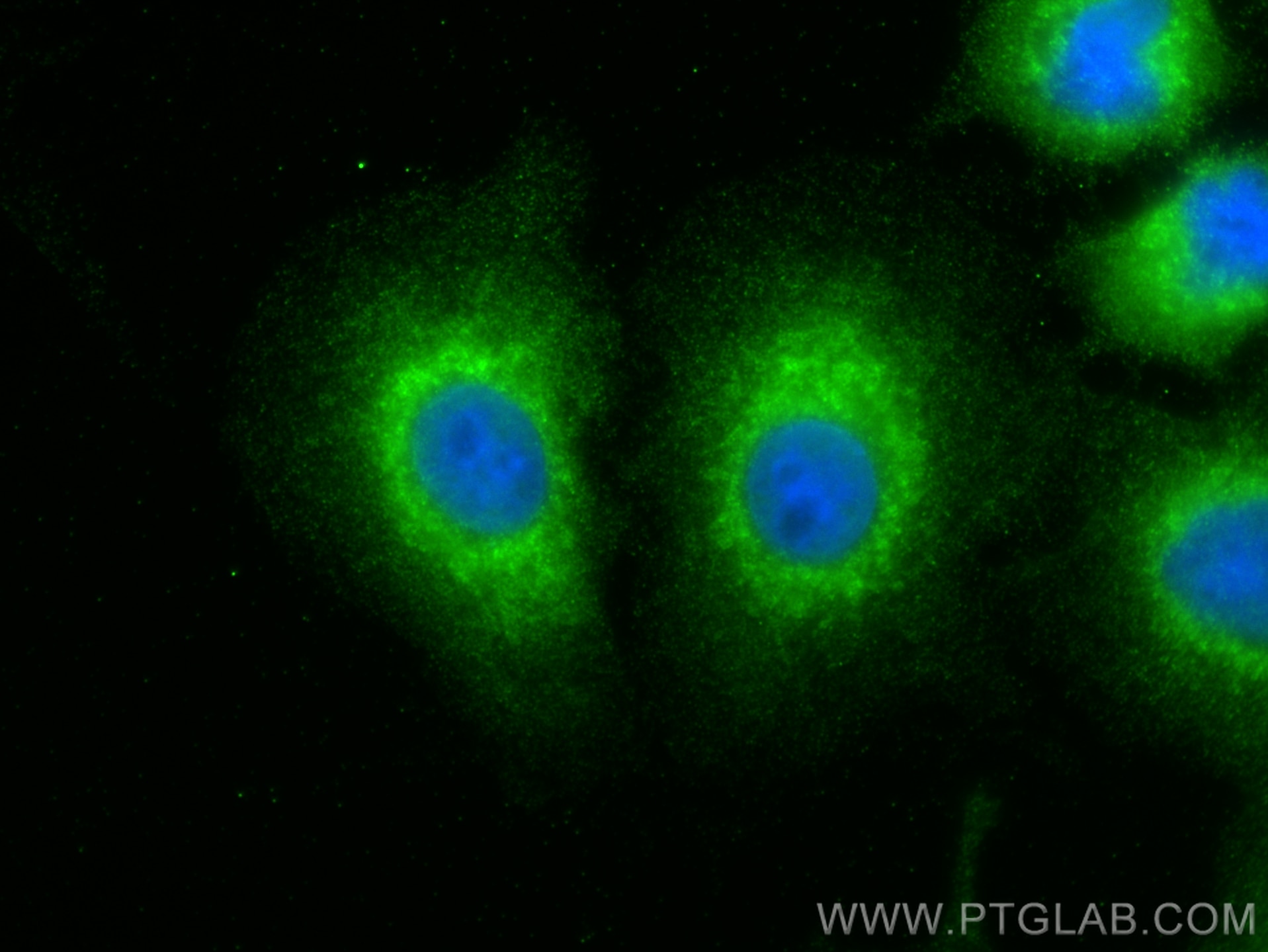 Immunofluorescence (IF) / fluorescent staining of A549 cells using LONP2 Polyclonal antibody (18035-1-AP)