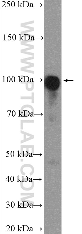 Western Blot (WB) analysis of Jurkat cells using LONP2 Polyclonal antibody (18035-1-AP)