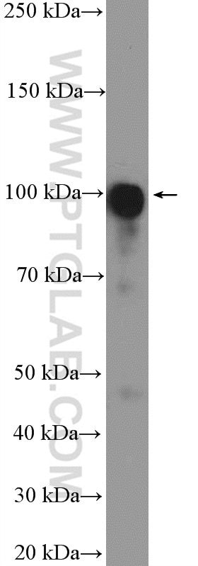 LONP2 Polyclonal antibody