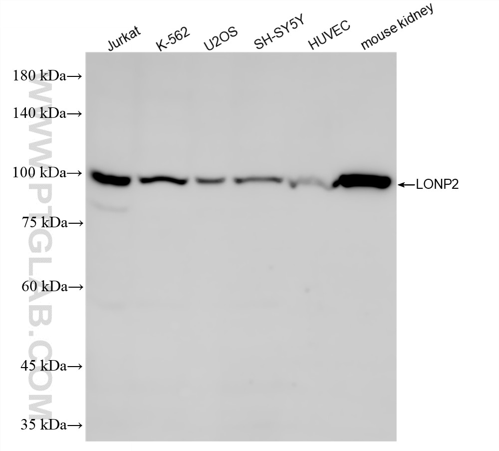 Various lysates were subjected to SDS PAGE followed by western blot with 86291-2-RR (LONP2 antibody) at dilution of 1:5000 incubated at room temperature for 1.5 hours. Western Blot (WB) analysis of various lysates using LONP2 Recombinant monoclonal antibody (86291-2-RR)