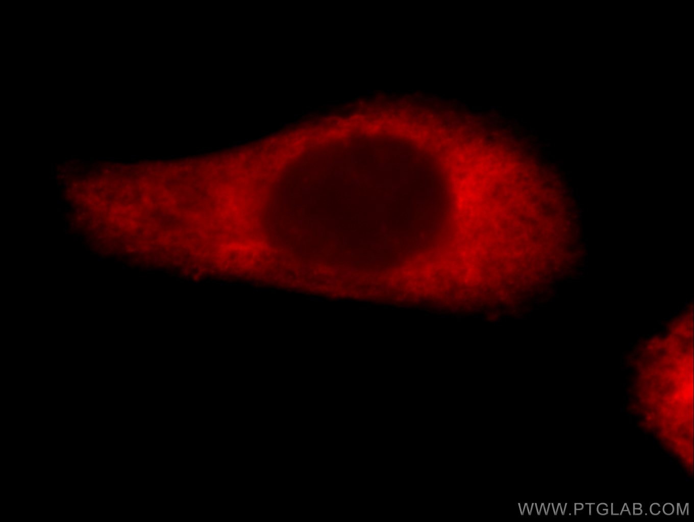 Immunofluorescence (IF) / fluorescent staining of A431 cells using Loricrin Polyclonal antibody (55439-1-AP)