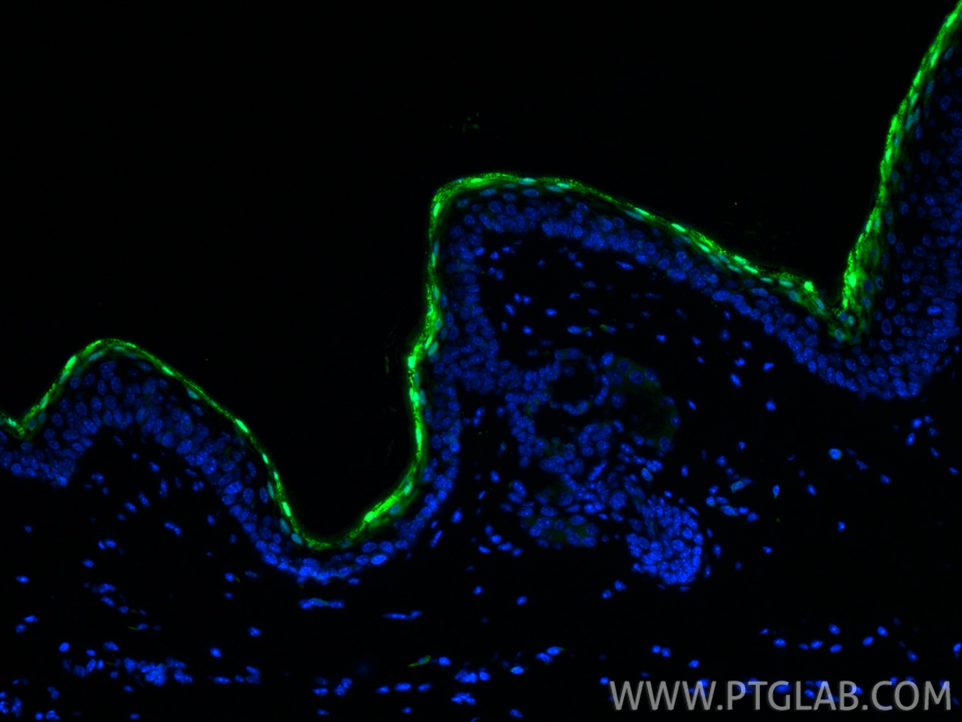 Immunofluorescence (IF) / fluorescent staining of mouse skin tissue using Loricrin Polyclonal antibody (55439-1-AP)