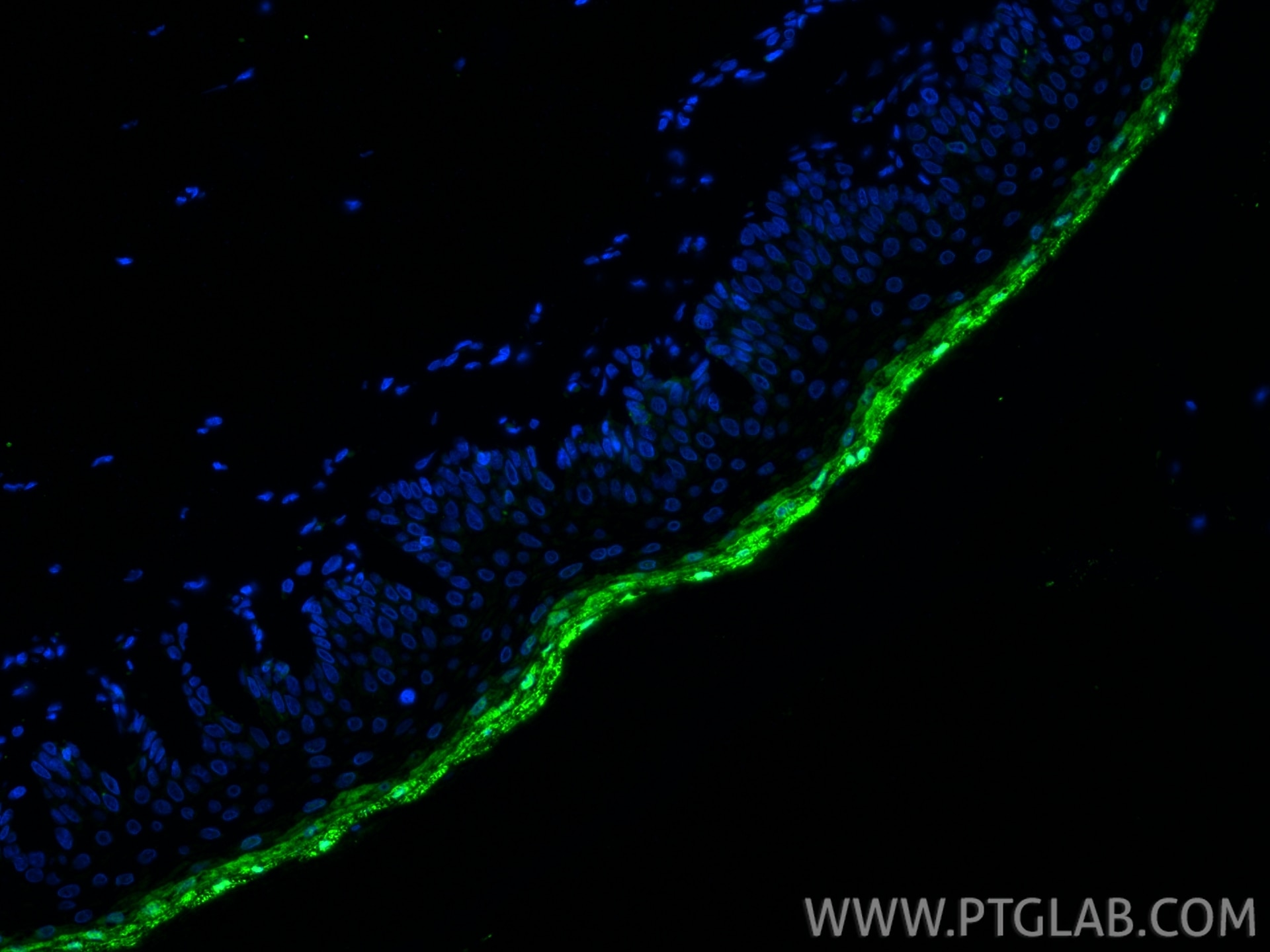 Immunofluorescence (IF) / fluorescent staining of rat skin tissue using Loricrin Polyclonal antibody (55439-1-AP)