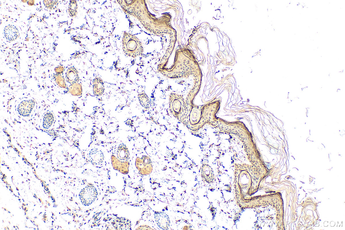 IHC staining of rat skin using 55439-1-AP