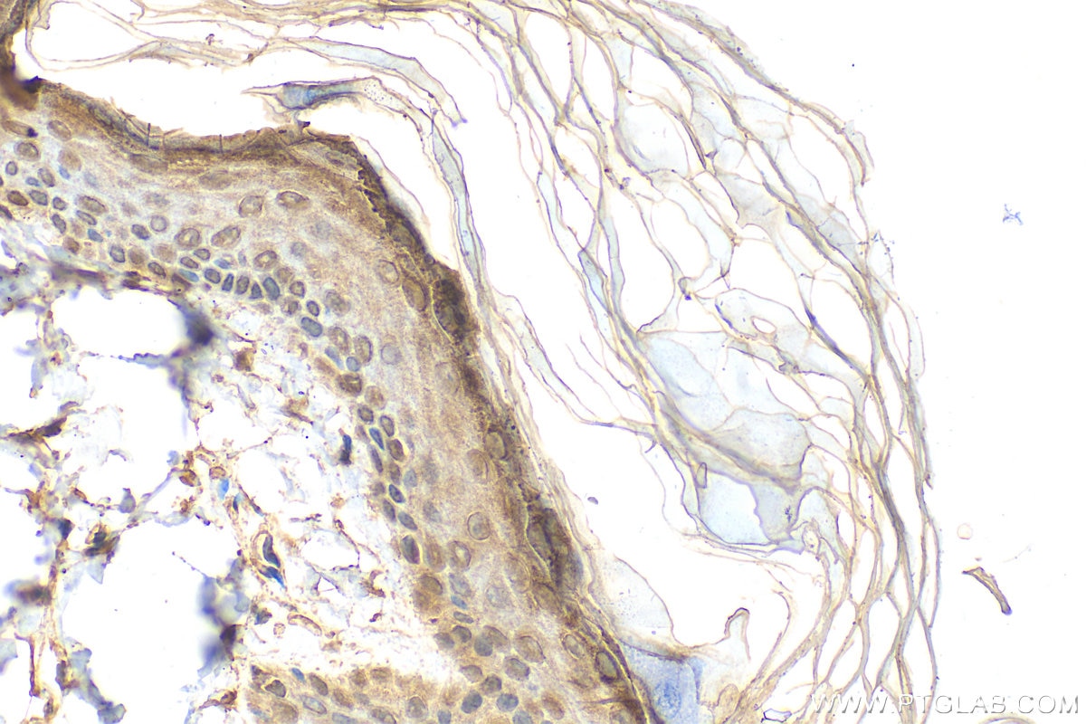 Immunohistochemistry (IHC) staining of rat skin tissue using Loricrin Polyclonal antibody (55439-1-AP)