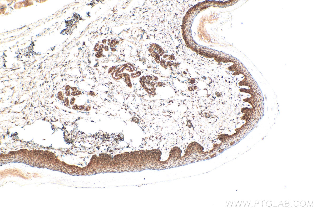 Immunohistochemistry (IHC) staining of mouse skin tissue using Loricrin Polyclonal antibody (55439-1-AP)