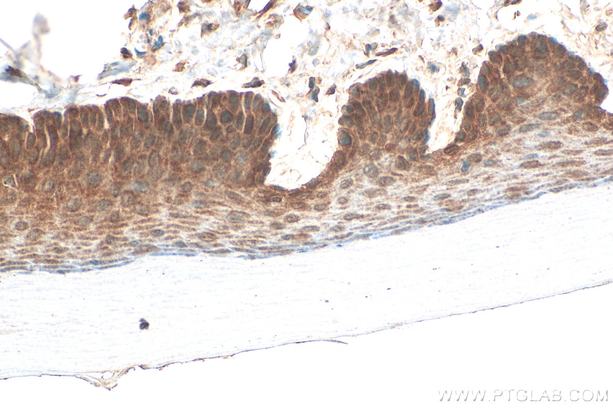 Immunohistochemistry (IHC) staining of mouse skin tissue using Loricrin Polyclonal antibody (55439-1-AP)