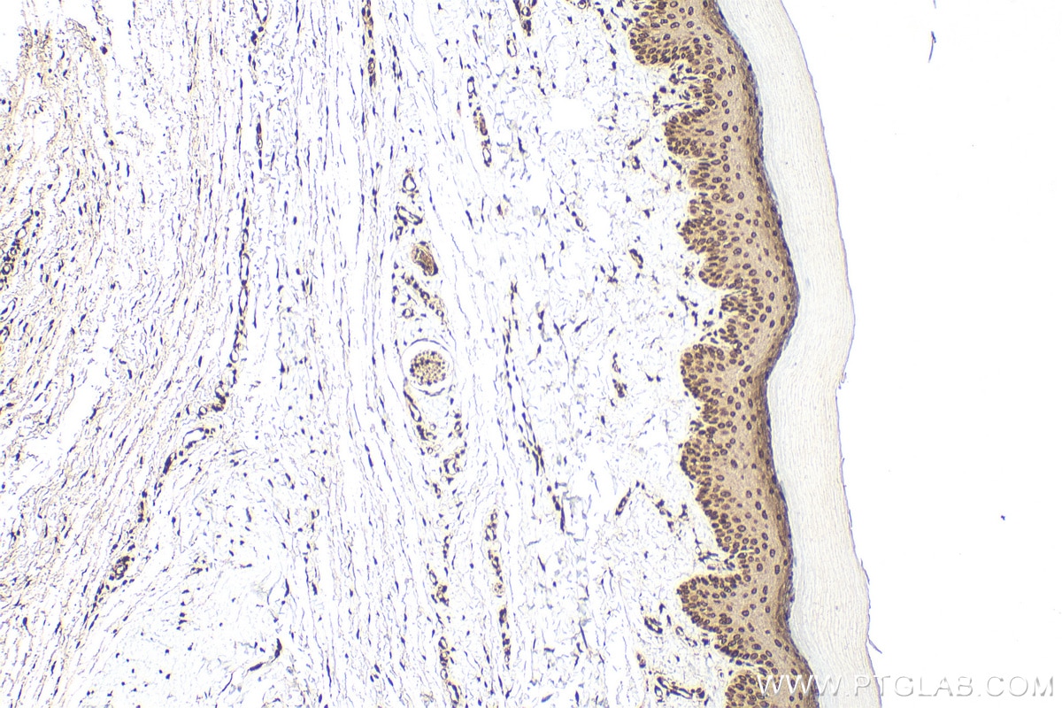 Immunohistochemistry (IHC) staining of rat skin tissue using Loricrin Polyclonal antibody (55439-1-AP)