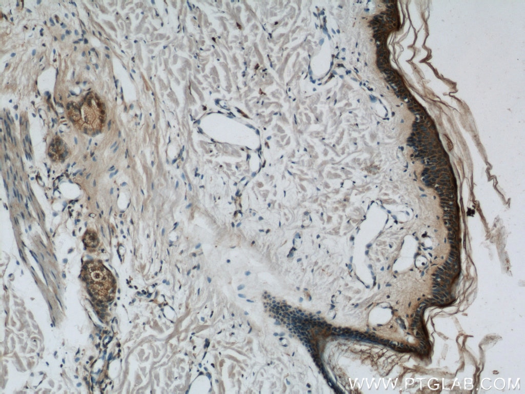 Immunohistochemistry (IHC) staining of human skin tissue using Loricrin Polyclonal antibody (55439-1-AP)