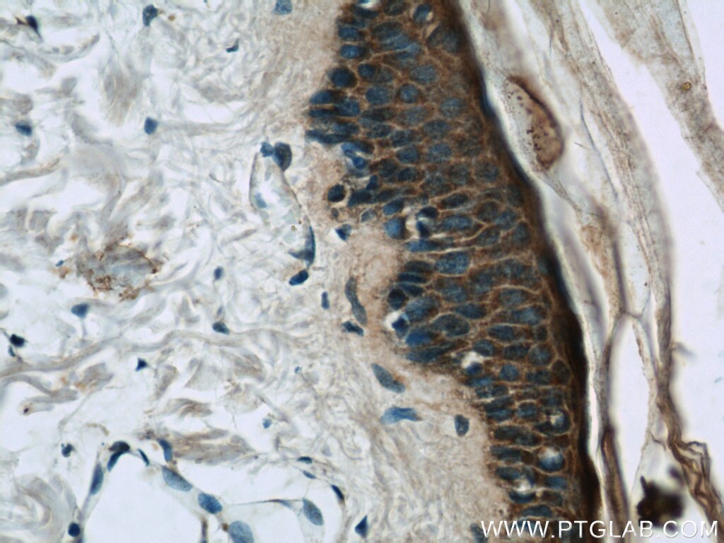Immunohistochemistry (IHC) staining of human skin tissue using Loricrin Polyclonal antibody (55439-1-AP)