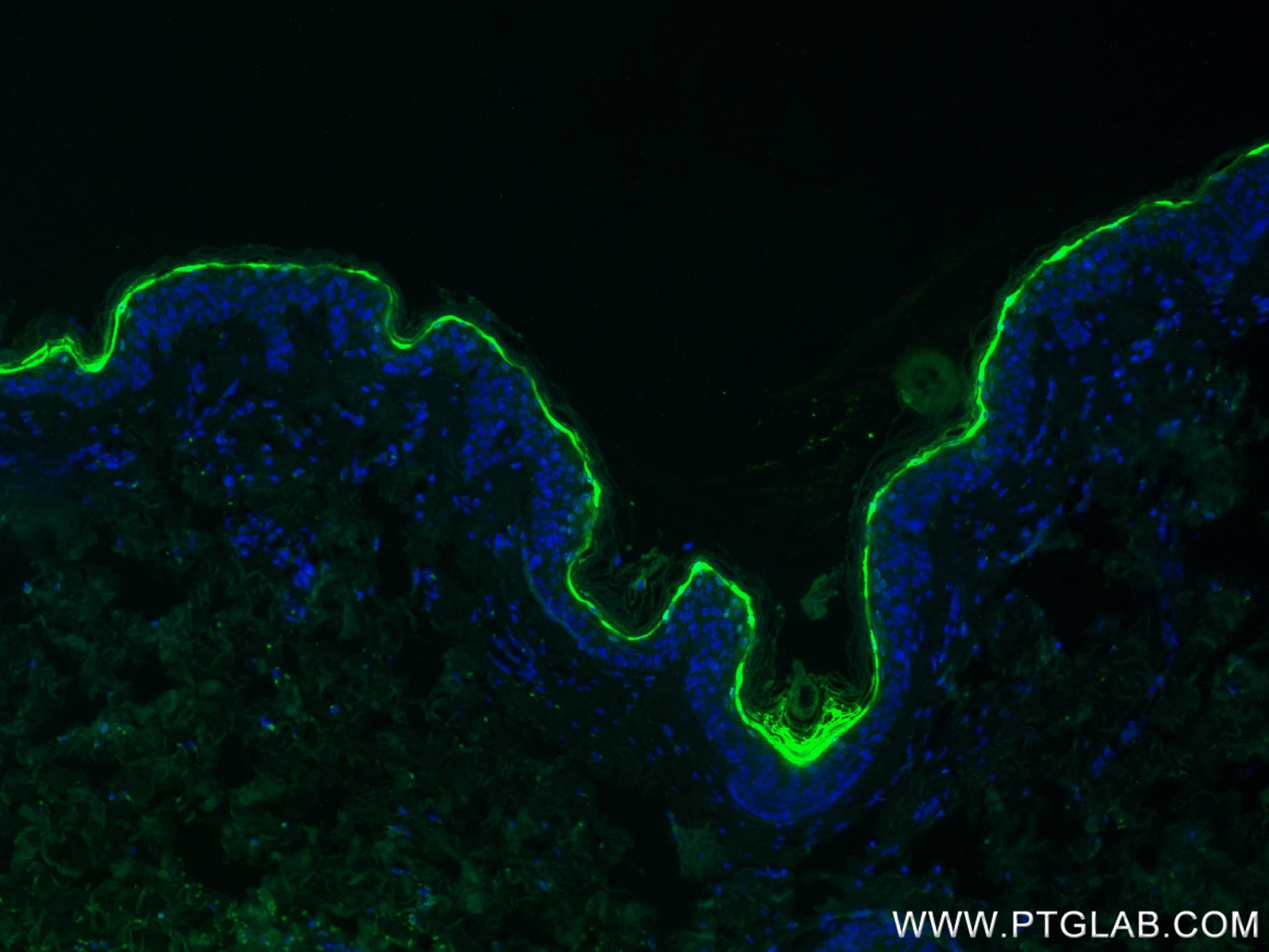 Immunofluorescence (IF) / fluorescent staining of human skin tissue using Loricrin Recombinant monoclonal antibody (83865-2-RR)