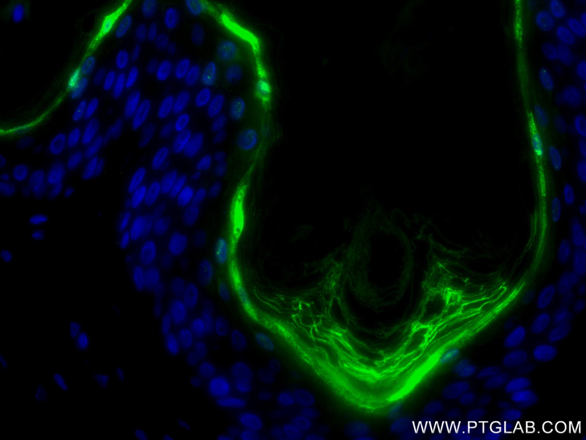 Immunofluorescence (IF) / fluorescent staining of human skin tissue using Loricrin Recombinant monoclonal antibody (83865-2-RR)
