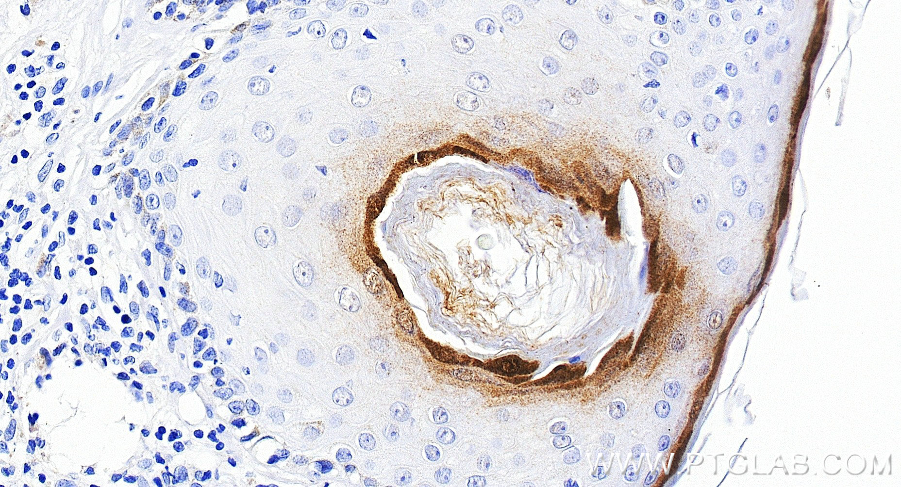 Immunohistochemistry (IHC) staining of human skin tissue using Loricrin Recombinant monoclonal antibody (83865-2-RR)