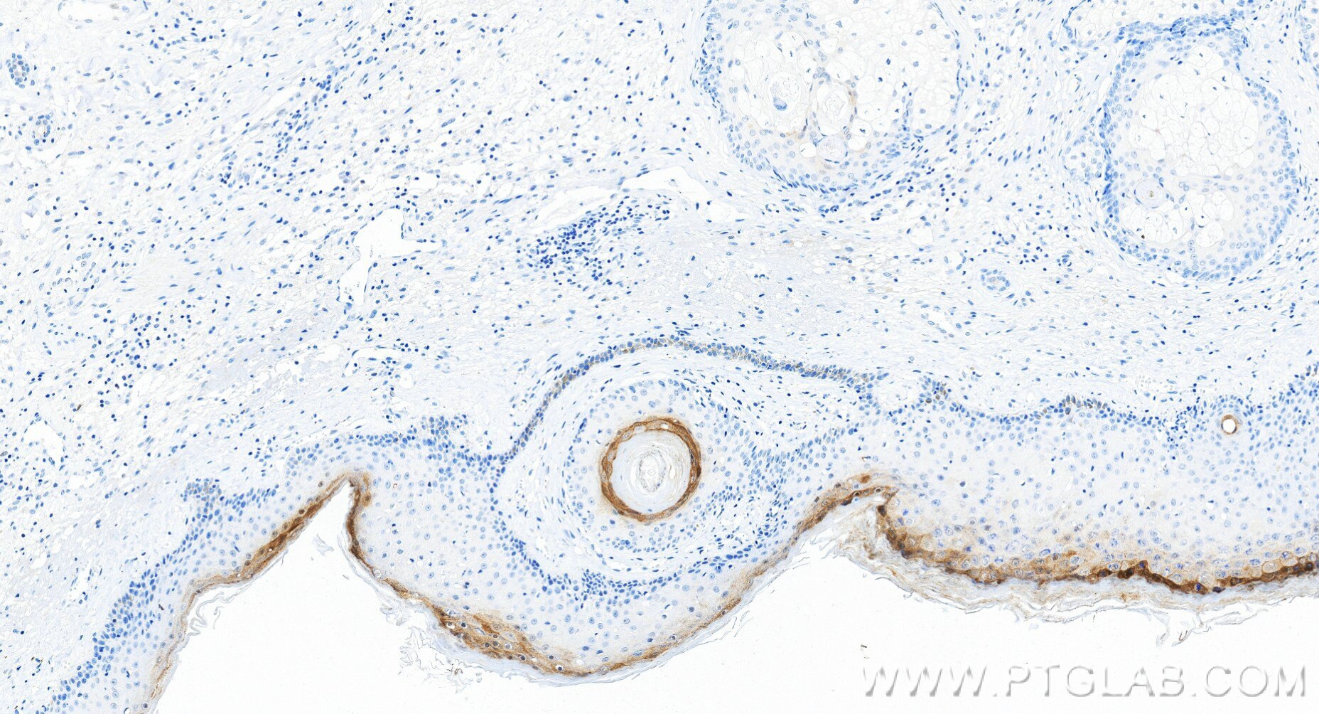 IHC staining of human skin using 83865-2-RR (same clone as 83865-2-PBS) Immunohistochemistry (IHC) staining of human skin tissue using Loricrin Recombinant monoclonal antibody (83865-2-RR)