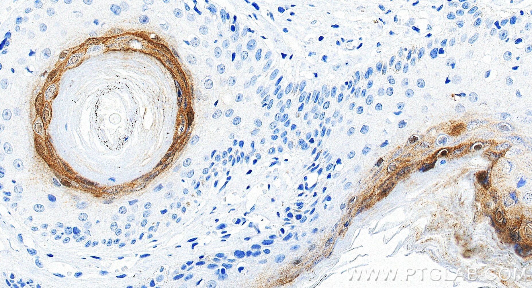 IHC staining of human skin using 83865-2-RR (same clone as 83865-2-PBS) Immunohistochemistry (IHC) staining of human skin tissue using Loricrin Recombinant monoclonal antibody (83865-2-RR)