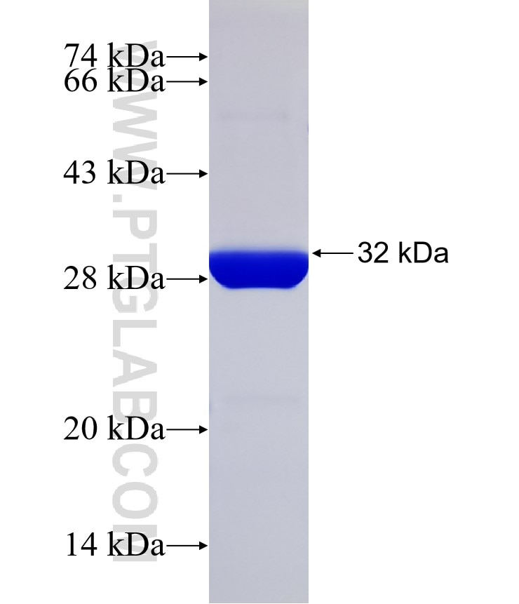 LOR fusion protein Ag32305 SDS-PAGE LOR fusion protein Ag32305 SDS-PAGE
