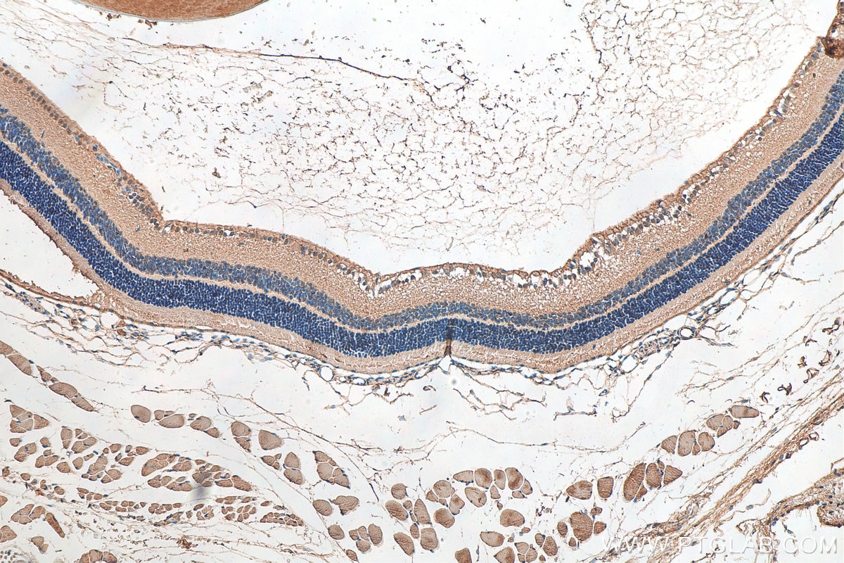 IHC staining of mouse eye using 17958-1-AP