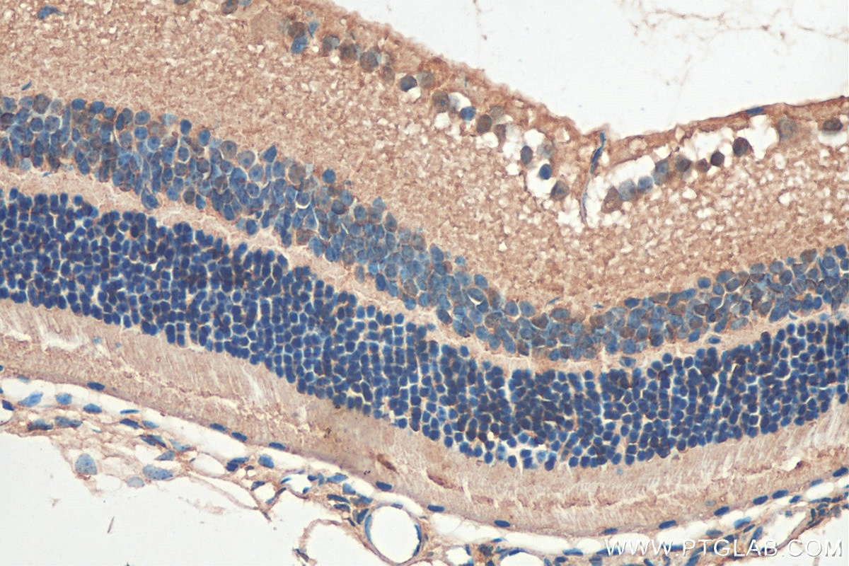 Immunohistochemistry (IHC) staining of mouse eye tissue using LOX Polyclonal antibody (17958-1-AP)