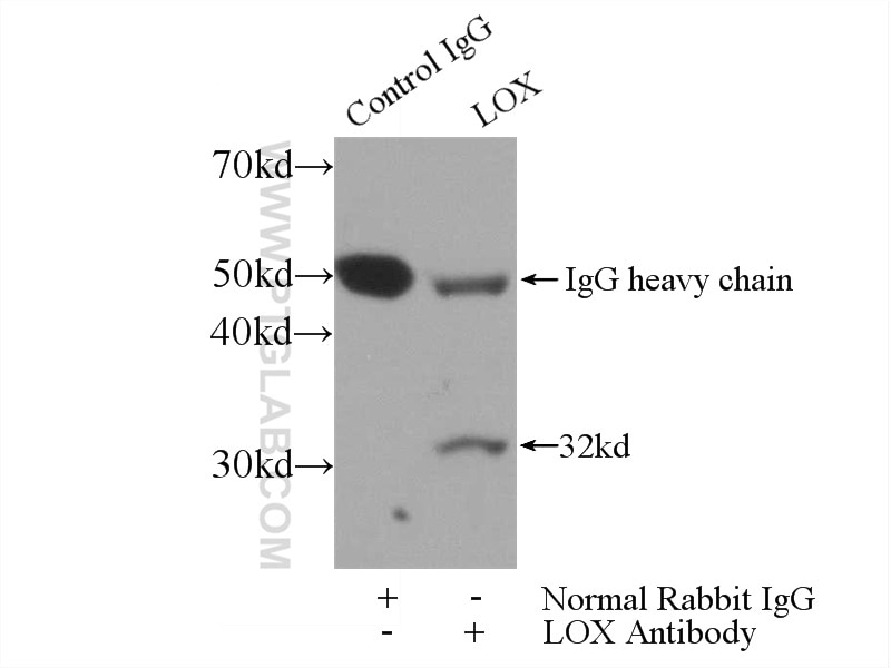 Immunoprecipitation (IP) experiment of mouse skeletal muscle tissue using LOX Polyclonal antibody (17958-1-AP)