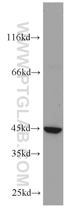 Western Blot (WB) analysis of MKN-45 cells using LOX Polyclonal antibody (17958-1-AP)