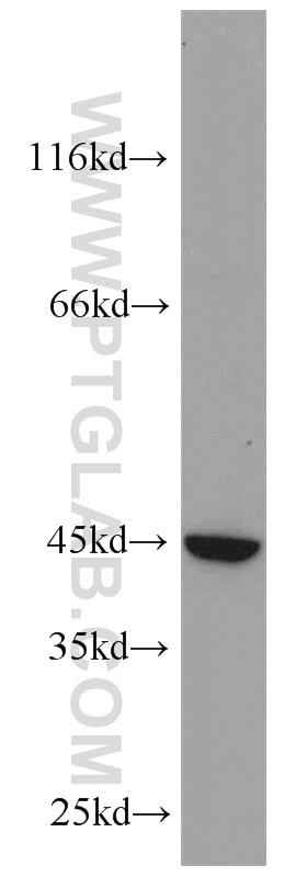 WB analysis of MKN-45 using 17958-1-AP