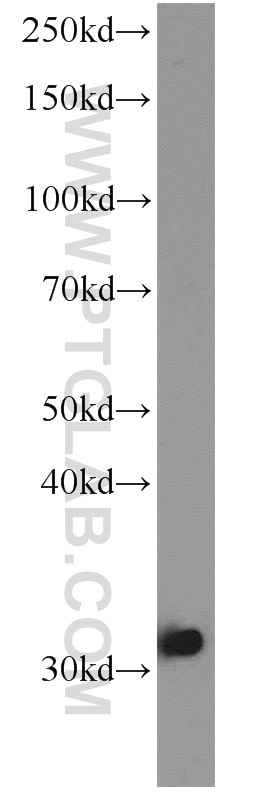 Western Blot (WB) analysis of SGC-7901 cells using LOX Polyclonal antibody (17958-1-AP)