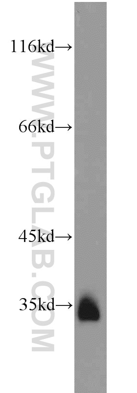 Western Blot (WB) analysis of NIH/3T3 cells using LOX Polyclonal antibody (17958-1-AP)