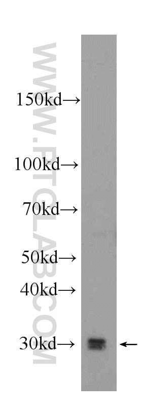 Western Blot (WB) analysis of mouse skeletal muscle tissue using LOX Polyclonal antibody (17958-1-AP)