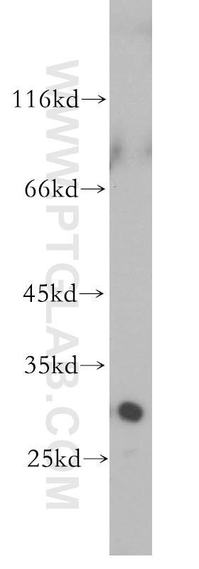 Western Blot (WB) analysis of Jurkat cells using LOX Polyclonal antibody (17958-1-AP)