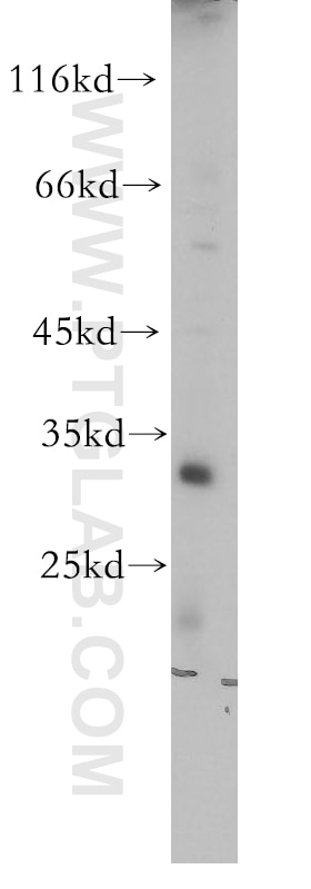 Western Blot (WB) analysis of A375 cells using LOX Polyclonal antibody (17958-1-AP)